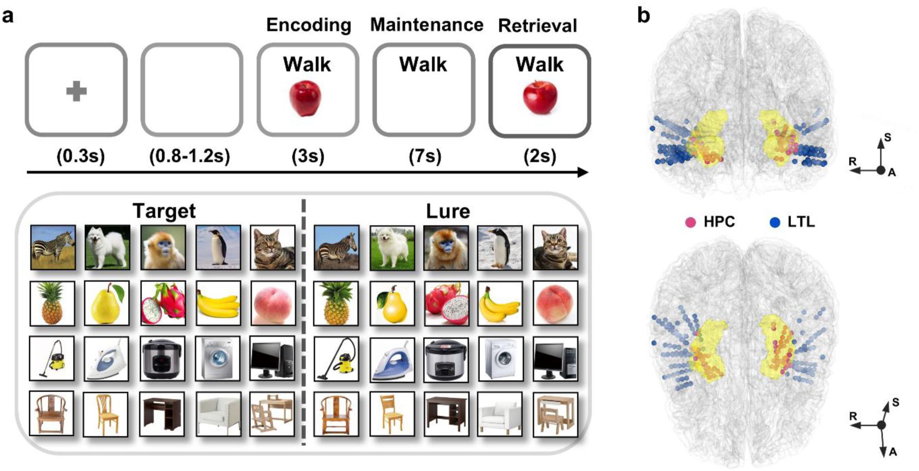 Ramping-up hippocampal ripples and their neocortical coupling support human visual short-term memory